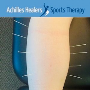 Achilles Healers Medical Acupuncture