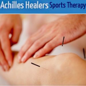 Medical Acupuncture Dry Needling